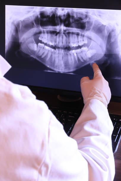 Best Emergency Root Canal Treatment in Colona, IL