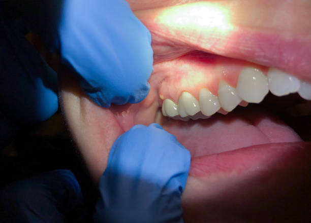 Best Emergency Dental Services for Seniors in Colona, IL