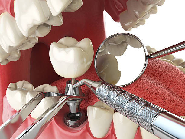 Best Weekend Emergency Dentist in Colona, IL